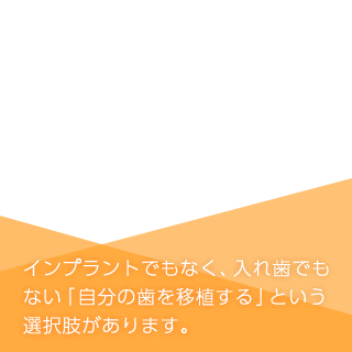 親知らずの移植